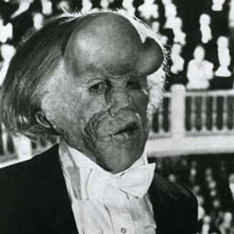 comment se termine Elephant Man
